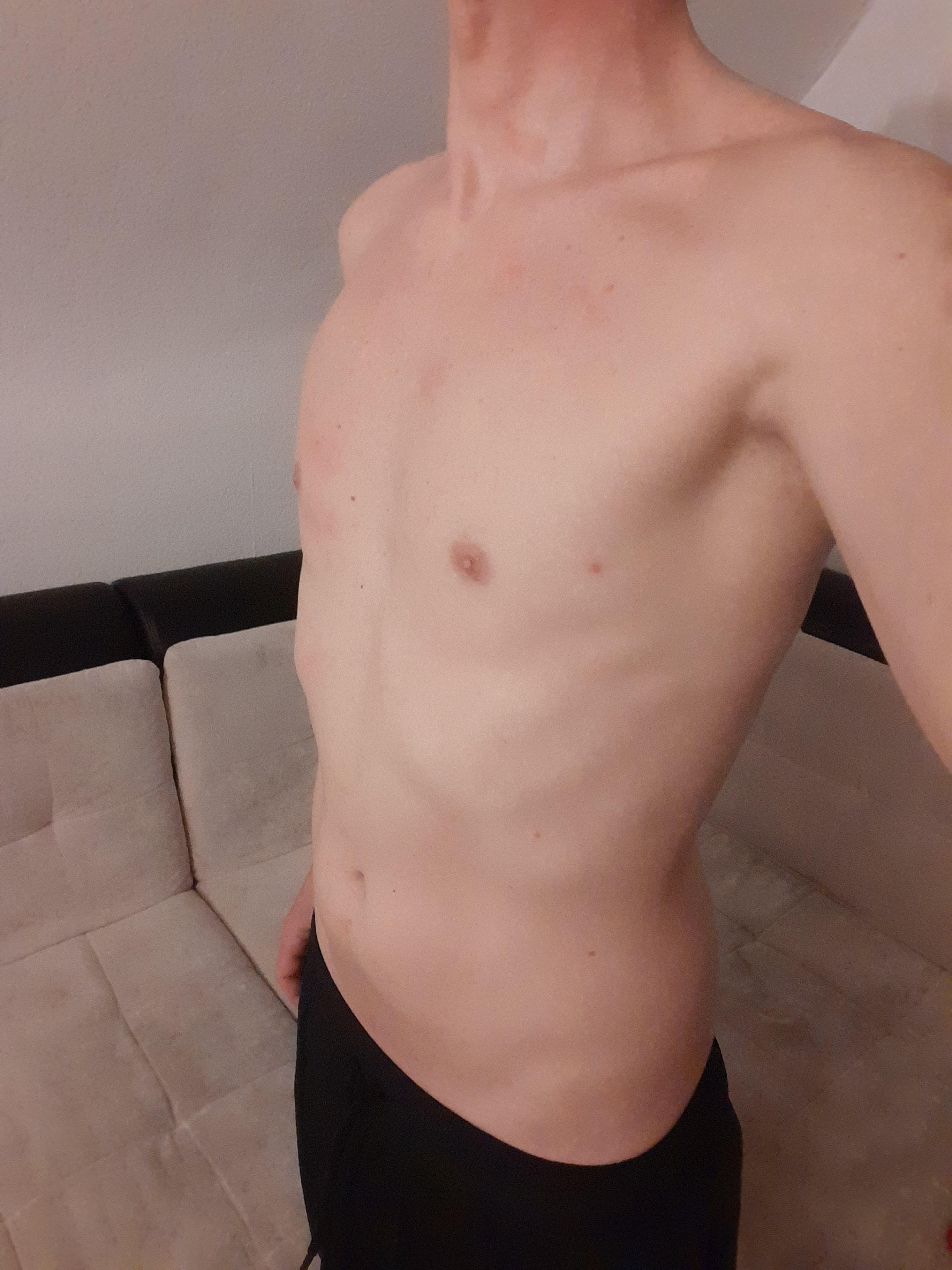 Nymphofux