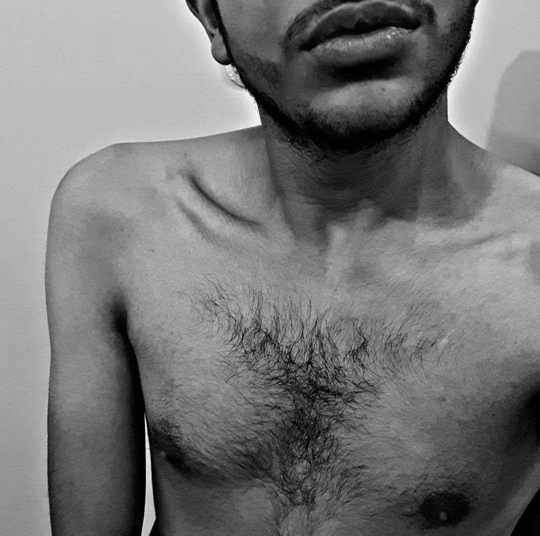 medo_22cm Live Image